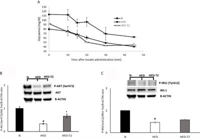 3,5-Diiodo-L-Thyronine (T2) Administration Affects Visceral Adipose Tissue Inflammatory State in Rats Receiving Long-Lasting High-Fat Diet